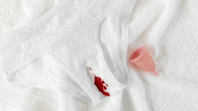 A menstrual cup alongside stained underwear on a clean towel, symbolizing menstrual health.